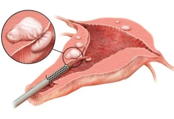 Какие роллы выбрать новичку: гид по видам и начинкам