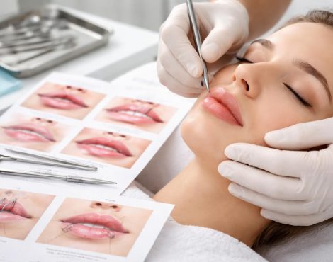 Хейлопластика, что это такое