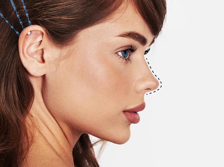 ринопластика в москве